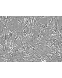 人类肾上腺微血管内皮细胞（HAdMEC）- 相差显微镜，200倍