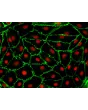 人类肾上腺微血管内皮细胞（HAdMEC）- CD31免疫染色，400倍
