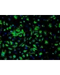 人类肾小球内皮细胞（HRGEC）- 免疫染色，标记 vWF，200倍显微镜放大。
