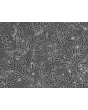 人类肾小管系膜细胞 (HRMC) - 相差显微镜，100倍。