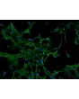 人类肾小管系膜细胞 (HRMC) - 纤维连接蛋白免疫染色，200倍。