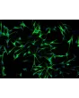人类表皮黑素细胞-成人 (HEM-a) - S100-β免疫染色，100倍