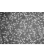 人类表皮黑素细胞-黑色 (HEM-d) - 相差显微镜，100倍