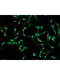 人类表皮黑素细胞-黑色 (HEM-d) - 波形蛋白免疫染色，200倍