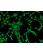 Bovine Lens Epithelial Cells (BLEpiC)-Immunostaining for CK-18, 200X.