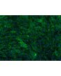 Bovine Meningeal Cells (BMC)-Immunostaining for FN, 200X