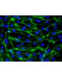 HiPSC-Derived Endothelial Cells (HiPSC-EC) -
Immunostaining for CD31, 200x
