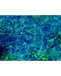 HiPSC-Derived Neurons (HiPSC-N) - Immunostaining for Tuj1, 200x