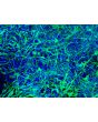 HiPSC-Derived Neurons (HiPSC-N) - Immunostaining for Tuj1, 200x