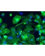 HPSC-Derived Cardiomyocytes (H9-CM) -  Immunostaining for α-actinin, 200x