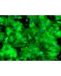 HPSC-Derived Cardiomyocytes (H9-CM) – Immunostaining for Tropomyosin, 200x