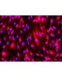 hPSC-Derived Endothelial Cells (hPSC-EC) -
Immunostaining for vWF, 200x
