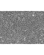 Human Adipose-derived Mesenchymal Stem Cells (HMSC-ad) - Phase contrast, 100x.