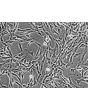 Human Adrenal Fibroblasts (HAdF) - Relief contrast