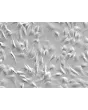 Human Adrenal Microvascular Endothelial Cells (HAdMEC) – Relief Contrast, 200x.
