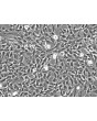 Human Amniotic Mesenchymal Stromal Cells (HAMSC) - Phase contrast, 200x.
