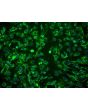 Human Amniotic Mesenchymal Stromal Cells (HAMSC) - Immunostaining for CD105