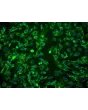 Human Amniotic Mesenchymal Stromal Cells (HAMSC) - Immunostaining for CD105, 200x.
