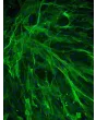 Human Aortic Smooth Muscle Cells (HASMC) - Immunostaining for α-SMA, 200x.