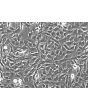 Human Astrocytes-brain stem (HA-bs) - Relief contrast