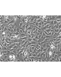 Human Astrocytes-brain stem (HA-bs) - Phase contrast, 200x.
