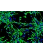 Human Astrocytes-brain stem (HA-bs) - mmunostaining for GFAP, 100x.
