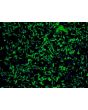 Human Astrocytes-cerebellar (HA-c) - Immunostaining for GFAP