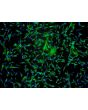 Human Astrocytes-midbrain (HA-mb) - Immunostaining for GFAP