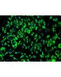Human Bladder Microvascular Endothelial Cells (HBdMEC) - Immunostaining for Factor VIII
