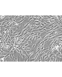 Human Bladder Stromal Fibroblasts (HBdSF) - Phase contrast, 200x.
