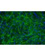 Human Bladder Stromal Fibroblasts (HBdSF) - Immunostaining for Fibronectin