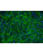 Human Bladder Stromal Fibroblasts (HBdSF) - Immunostaining for Fibronectin, 200x.
