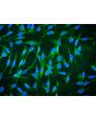 Human Bone Marrow-derived Mesenchymal Stem Cells (HMSC-bm) - Relief contrast