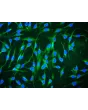 Human Bone Marrow-derived Mesenchymal Stem Cells (HMSC-bm) - Immunostaining for CD90, 200x.
