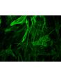 Human Brain Vascular Smooth Muscle Cells [HBVSMC] - Immunostaining for α-SMA, 400x.