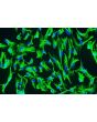 Human Choroid Plexus Epithelial Cells (HCPEpiC) - Immunostaining for CK-18