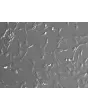 Human Colonic Fibroblasts (HCoF)- Relief Contrast, 200x
