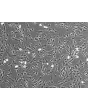 Human Colonic Fibroblasts (HCoF)- Phase Contrast, 100x
