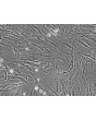 Human Dermal Fibroblasts-Fetal-Mitomycin C treated (HDF-f-mt) - Phase contrast, 200x.
