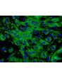 Human Dermal Microvascular Endothelial Cells (HDMEC) - Immunostaining for Factor VIII