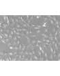 Human Dural Fibroblasts - Relief Contrast, 200x
