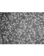 Human Epidermal Melanocytes-dark (HEM-d) - Phase contrast, 100x.

