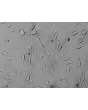 Human Epidermal Melanocytes-dark (HEM-d) - Relief contrast, 400x.
