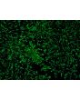 Human Epidermal Melanocytes-light (HEM-l) - Immunostaining for S100-&beta;