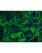 Human Esophageal Smooth Muscle Cells (HESMC) - Immunostaining for &alpha;-SMA