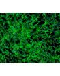 Human Hair Inner Root Sheath Cells (HHIRSC) - Immunostaining for Fibronectin