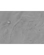 Human Hair Outer Root Sheath Cells (HHORSC) - Phase contrast