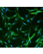 Human Hepatic Stellate Cells (HHSteC) - Immunostaining for α-SMA, 400x.
