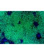 HiPSC-Derived Neural Crest Cells (HiPSC-NCC) - Immunostaining for SOX10, 100x