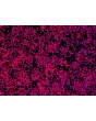 HiPSC-Derived Neural Stem Cells (HiPSC-NSC) - Immunostaining for Sox2, 200x